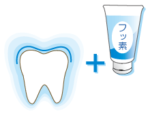 フッ素塗布