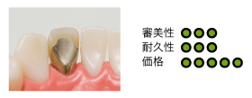 レジン前装冠