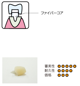 ファイバーコア